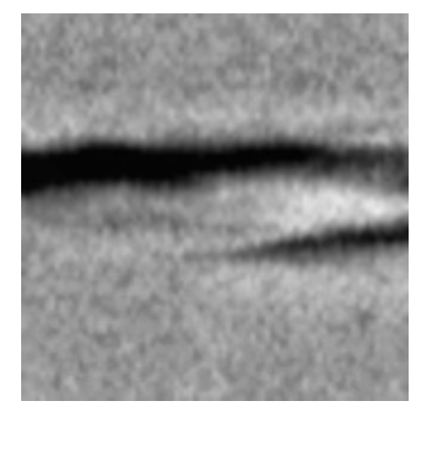 After contrast enhancement